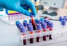 Laboratorios públicos en Venezuela solo operan con el 20 % de los insumos