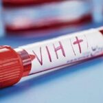 El SIDA necesita políticas y atención independiente para transformar la respuesta