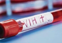 El SIDA necesita políticas y atención independiente para transformar la respuesta