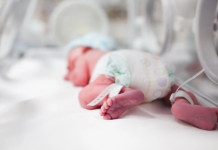 Registran tasa del 70 % de nacimientos prematuros en Monagas