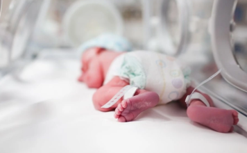 Registran tasa del 70 % de nacimientos prematuros en Monagas