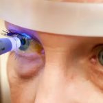 Sociedad Venezolana de Oftalmología advierte sobre los peligros del glaucoma glaucoma